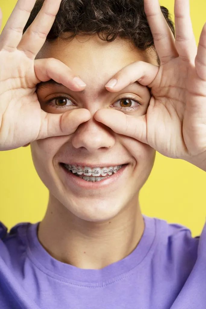 Lingual braces invisible behind teeth